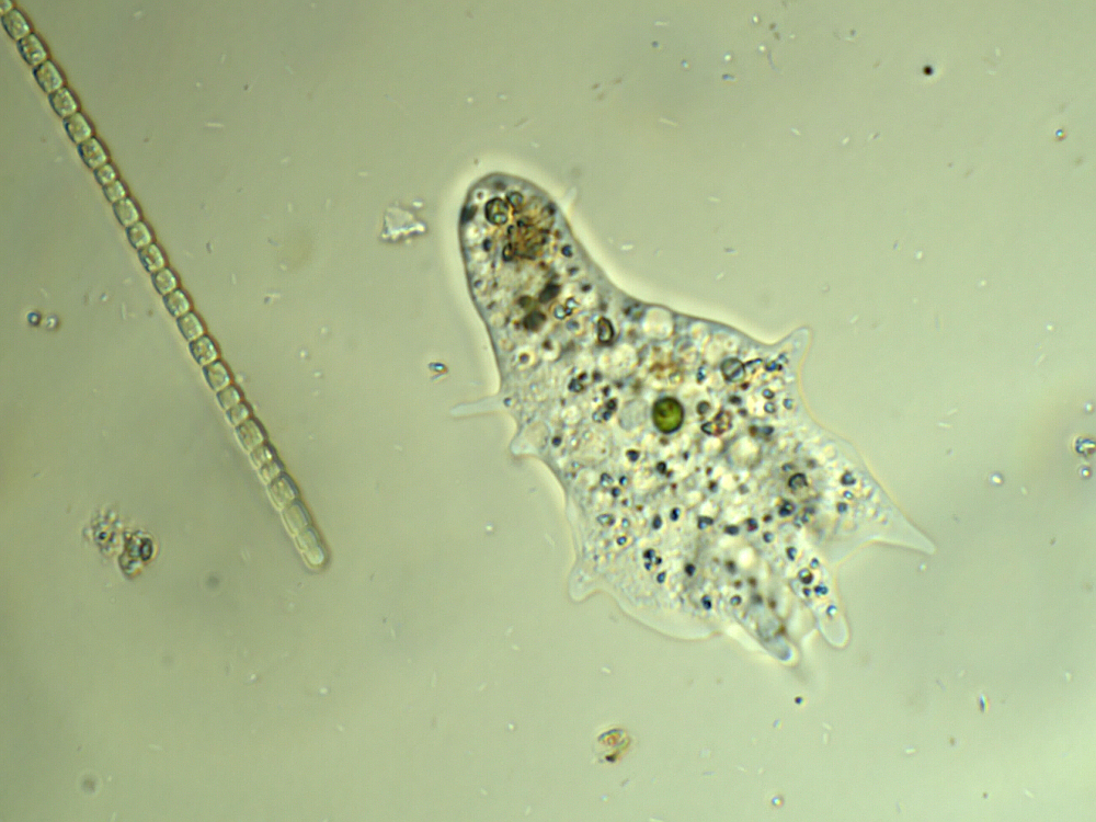 Ameba pod mikroskopem – Mikroskopia